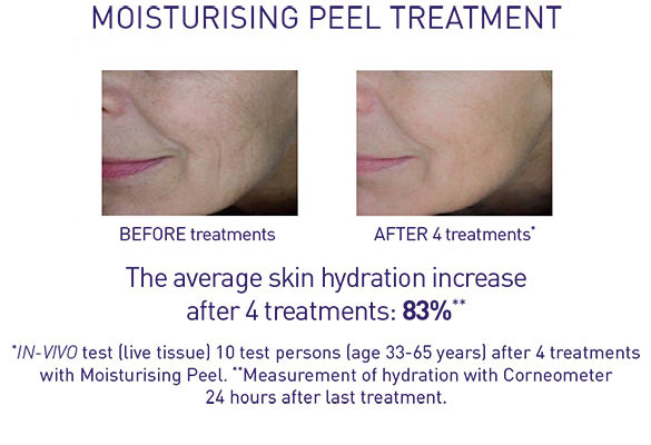 Moisturising treatment